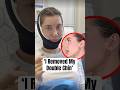 'I Removed My Double Chin' #shorts #summerfox #beautyinfluencer