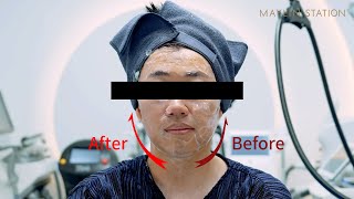 콰트로 리프팅 &#39;포트라 사용법 및 소개 영상&#39; - 메이린클리닉 청담점 박현준 대표원장님