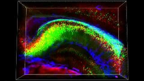 3-D Analysis of Intact Mouse Hippocampus