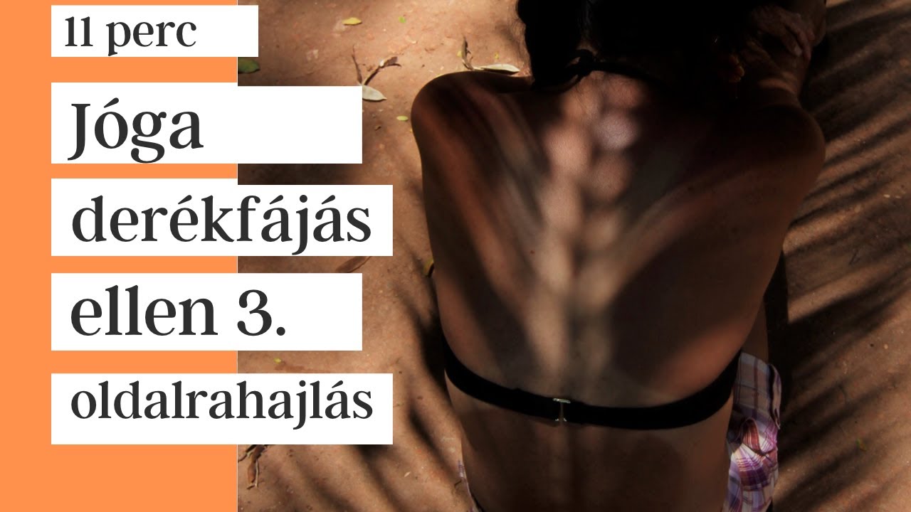 kéz artritisz kenőcs áttekintés