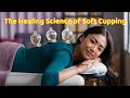 The Healing Science of Soft Cupping
