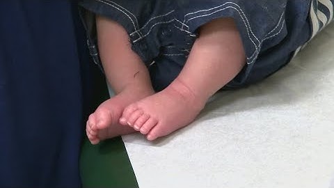 Measles cases at an all-time high since disease was eradicated in 2000