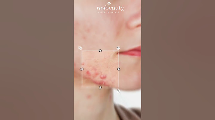 Skincare Routine For Acne | Raw Beauty Wellness