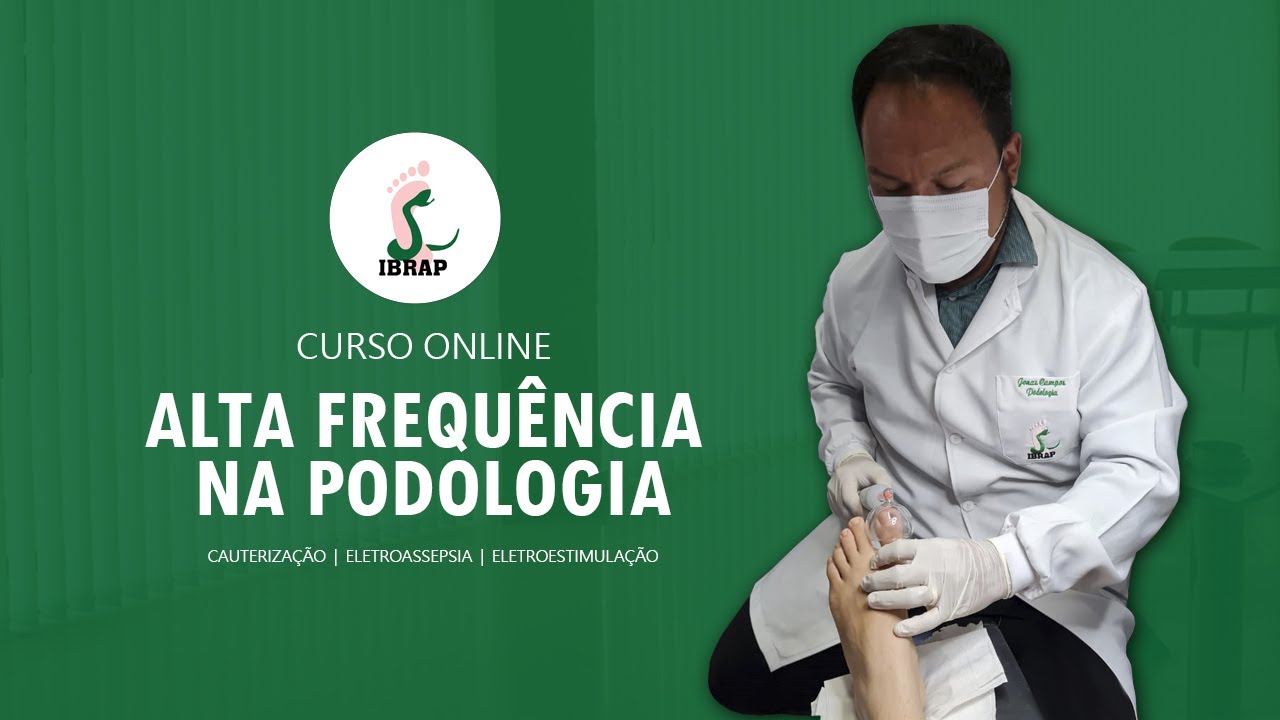Alta Frequência na Podologia