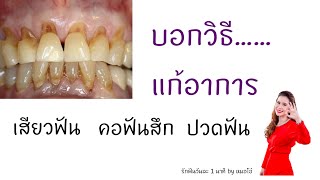 #เสียวฟัน #คอฟันสึก #ปวดฟัน ฟันแตก ฟันกร่อน รักษายังไง/รักฟันวันละ1นาทีbyหมอโอ๋