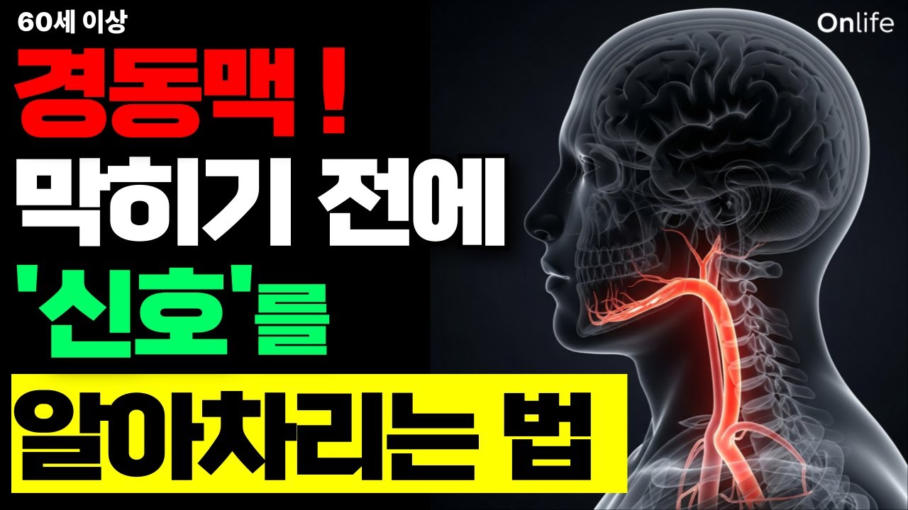 경동맥 막히기 전 ‘3가지 신호’ 지금 확인하세요