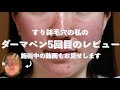 【すり鉢毛穴】5回目のダーマペンレビュー/施術中の動画もアップします! クリニック紹介/金額/施術/肌の経過/効果について（開き毛穴/いちご鼻/ニキビ跡/角栓/黒ずみ/酒さ/ニキビ肌）
