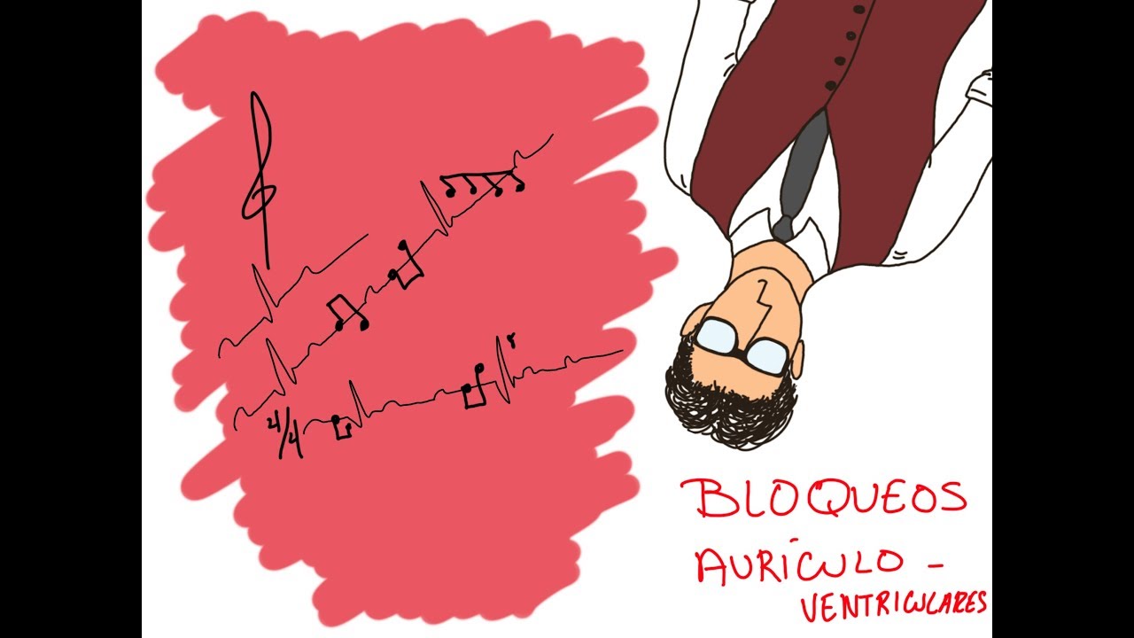 BLOQUEOS AV COMO NADIE TE LOS HA EXPLICADO!!!!