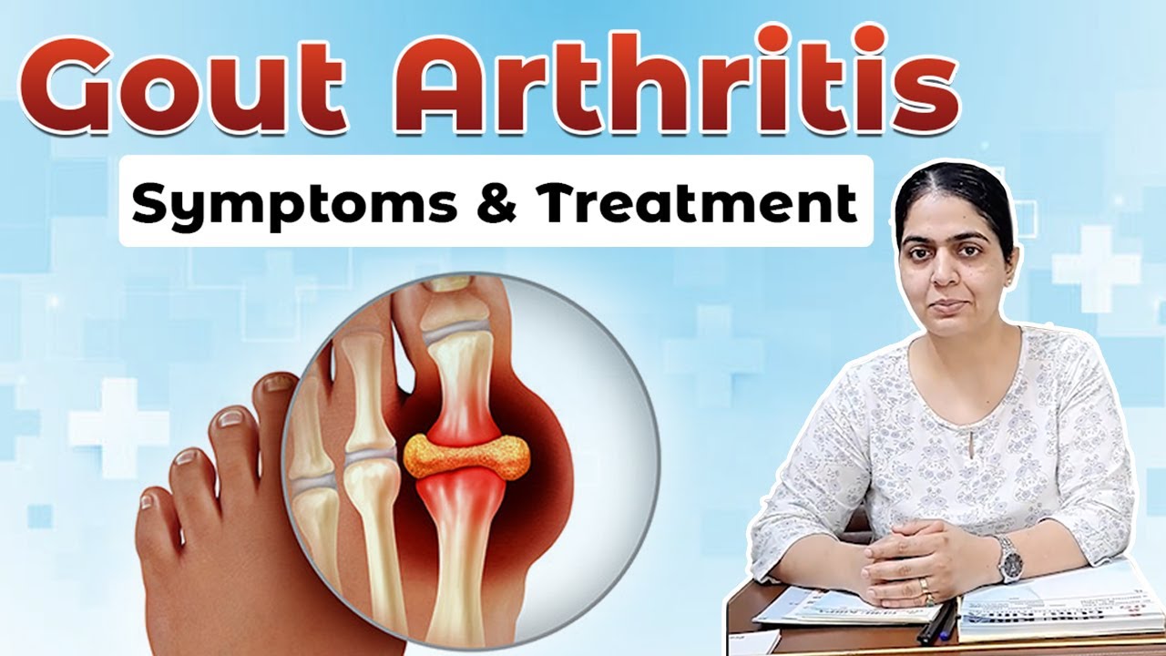Gout Arthritis Causes, Symptoms & Treatment Dr. Harsimranjot Kaur