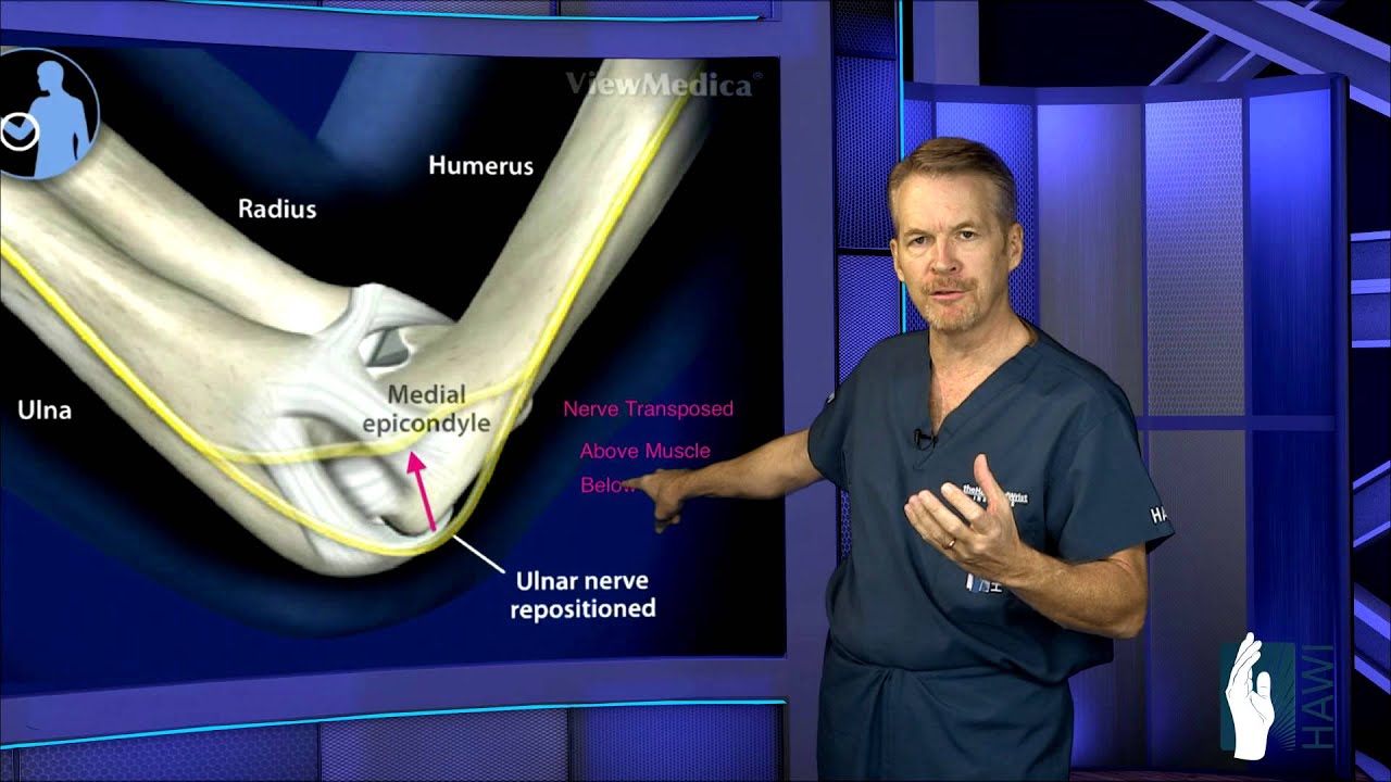 What is Ulnar Nerve Entrapment?