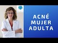 ACNÉ MUJER ADULTA