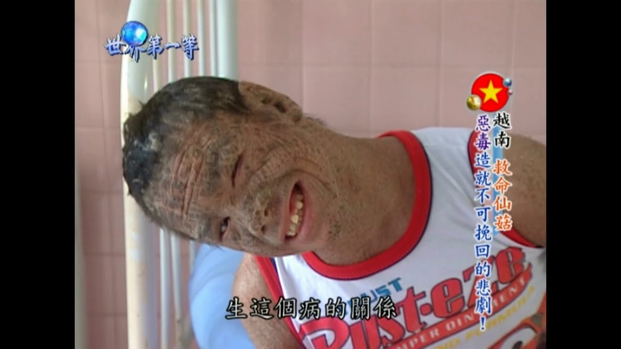 【越南】越戰橙劑遺毒 拜訪和平村無辜受害者｜《世界第一等》452集精華版