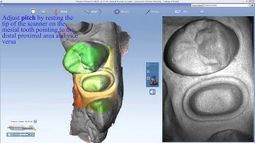E4D video 4 Interproximal Scan