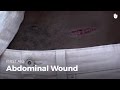 Learn first aid gestures abdominal wound