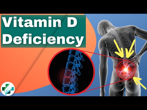 व्हिटॅमिन डीच्या कमतरतेची लक्षणे | व्हिटॅमिन डीच्या कमतरतेची चिन्हे