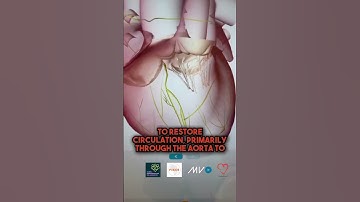 The Most Dangerous Arrhythmia ⚠️