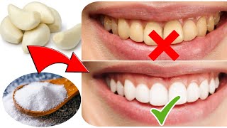 Natural Ways to Whiten Teeth at Home | Home Remedy for Yellow Teeth In Urdu