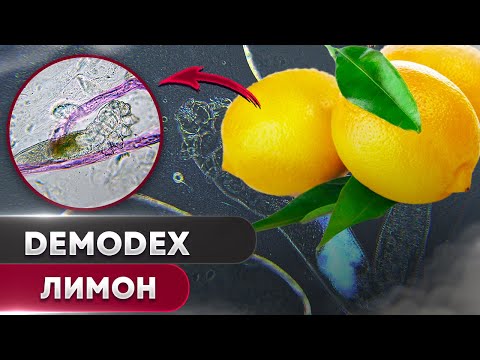 🍋 Лимон против клеща | Угревая Железница Demodex