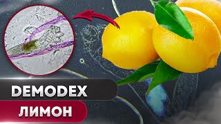 🍋 Лимон против клеща | Угревая Железница Demodex