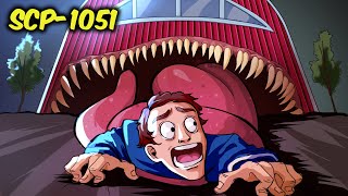 : SCP-1051  ,  .   ( SCP)