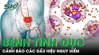 Bệnh Tình Dục Nguy Hiểm Cảnh Báo Những Dấu Hiệu Và Triệu Chứng Dễ Nhận Biết Skđs