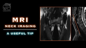 MRI – NECK IMAGING – A USEFUL TIP
