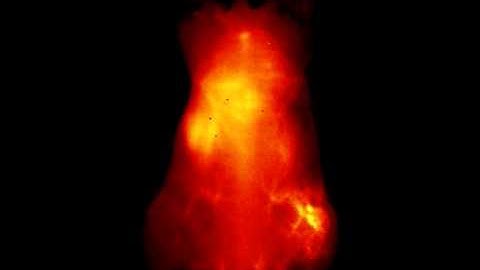 NIR-II Fluorescence Imaging Helps Pinpoint a Tumor’s Location