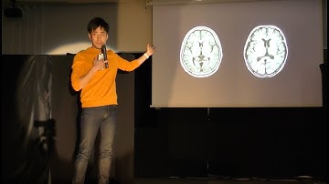 Technology Meets Neuroscience  テクノロジーと神経科学の融合 | Junichi Ushiba | TEDxKeioHighSchool