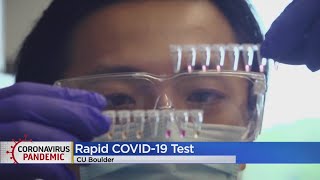 University Of Colorado Boulder Researcher Develop Saliva COVID-19 Test