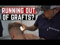 Am I running out of grafts!? Consultation with HLC!