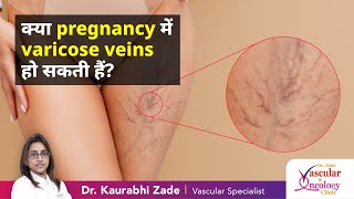 क्या pregnancy में varicose veins हो सकती हैं | Dr Kaurabhi Zade - Vascular and Oncology Clinic