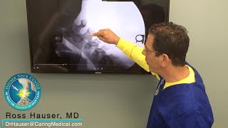 Case of Burning Mouth Syndrome - DMX review with Ross Hauser, MD