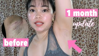 1 MONTH UPDATE USING DR. ALVIN UNDERARM WHITENING | Simply Yosh