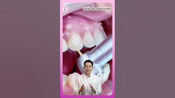 Tháo Mắc Cài Sau Niềng Răng Có Đau Không? | Bác Sĩ Tài Tử Tế #bacsitaitute #niengrang