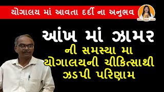 ઝામરની સમસ્યા મા યોગાલય ની ચીકિત્સાથી થી ઝડપી પરિણામ