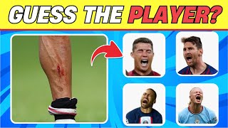 Guess Football Player by his INJURY and RED CARD ❤️‍🩹🏐 Football Quiz about Ronaldo, Messi