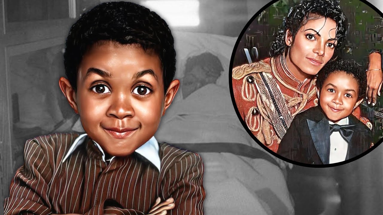 How Emmanuel Lewis Helped Michael Jackson Recover From His Pepsi Accident? | MJ Forever