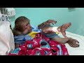 Monkey Asher&#39;s healing journey in the veterinary clinic