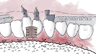 How Xylitol Works | Spry Dental Defense from Xlear