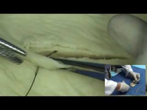 02 Enseanza de tcnicas bsicas de sutura en modelos...
