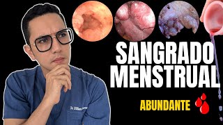 Sangrado menstrual abundante, todo lo que debes saber | Dr. William Guerrero Sangrado menstrual abundante, todo lo que debes saber | Dr. William Guerrero