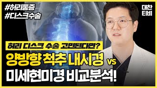 [고민해결해주는의사] #허리디스크 수술 양방향척추내시경…