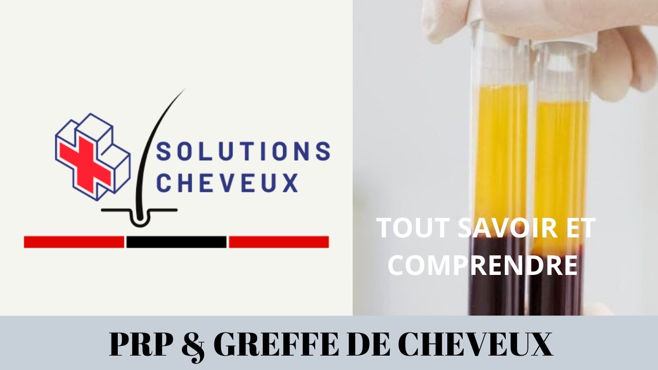 C'est quoi le PRP ? Le