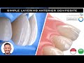 Simple Layering Anterior Composite PPT + Live Demo Class IV - SSRD April 2020