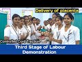 Active management of third stage of labour amtsl full procedure demonstrationdelivery of placenta