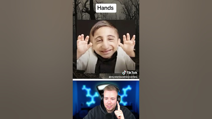 Menschen mit den kleinsten Körperteilen! 😨
