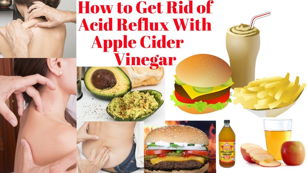 How To Get Rid Of Acid Reflux With Apple Cider Vinegar YouTube