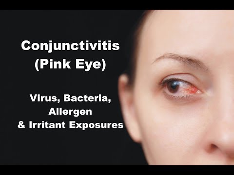 Conjunctivitis (Pink Eye) - Virus, Bacteria, Allergen & Irritant Exposures