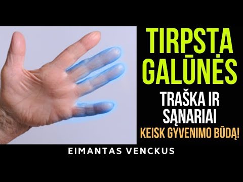 Video: Kojų Nutirpimas Nuo Kelio Iki Pėdos: Ligos Priežastys Ir Gydymas