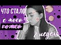 ПРОБЛЕМЫ С КОЖЕЙ||ВОДНАЯ ДИЕТА||ВТОРАЯ НЕДЕЛЯ||Oksana Portman